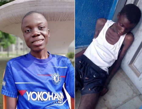 El este Victory. Băiețelul nigerian lăsat să moară de foame. Iată cum arată acum, după ce a fost salvat