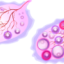 Cum afectează fertilitatea sindromul ovarelor polichistice