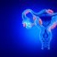 Fibromul uterin în sarcină: simptome și complicații