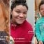 Viral pe TikTok: de ce gravidele au nasul în sarcina dublu în mărime