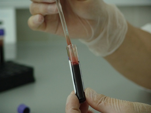 Cum se ia o proba de sange dintr-o eprubeta