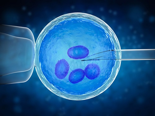 Tehnica de fertilizare in vitro