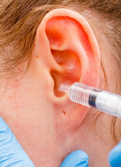 Incercare de eliminare a unei acumulari de ceara din urechi