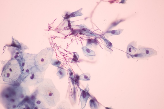 Candida la microscop