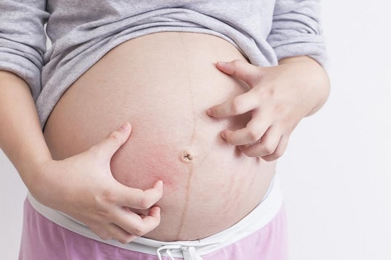 Femeie gravida ce se scarpina pe abdomen