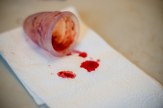 Cum Recunosti Sangerarea De Implantare Naste Natural