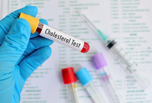colesterol la copii