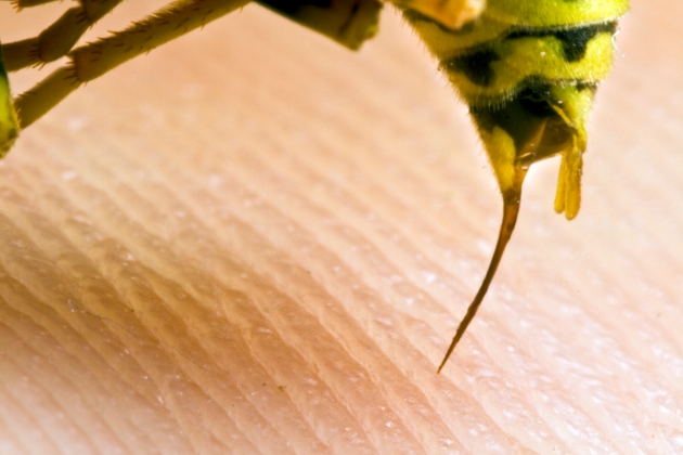 Cu ce se desumfla intepatura de viespe