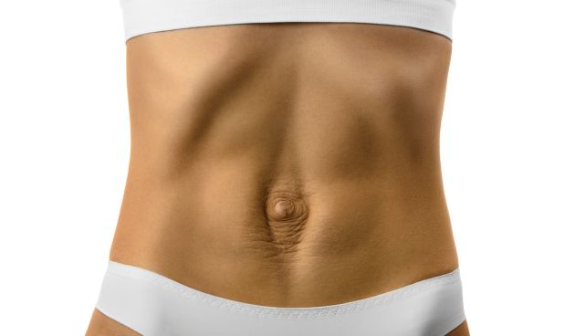 diastazis de muschi abdominal drept