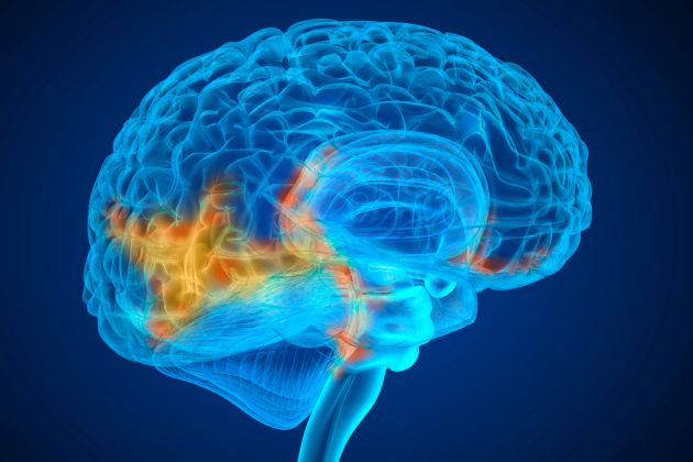 Durerile de cap persistente – pot fi un semn de cancer - Cancer