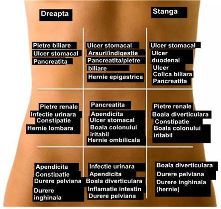 Durerile abdominale în partea stângă - Doza de Sănătate