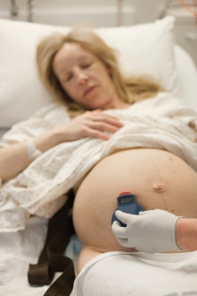 monitorizare fetala periodica