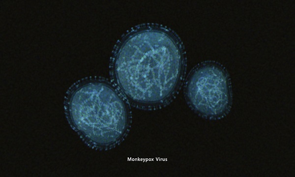 virusul care provoaca variola maimutei
