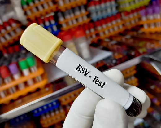test de sange pentru identificarea virusului sincitial respirator