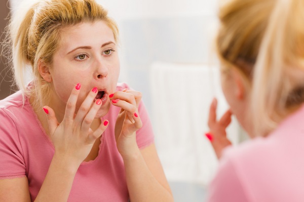 femeie care se uită în oglinda ca să vadă ce îi provoacă disconfort la nivelul gurii