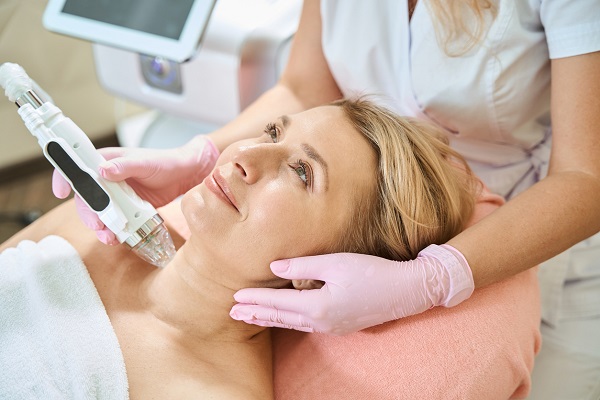 femeie in timpul procedurii numite microneedling