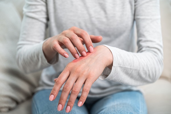 femeie imbracata cu o bluză gri, cu maneca lunga, si blugi, care stă pe canapea și se scarpină pe mâna, ceea ce determina inrosirea pielii