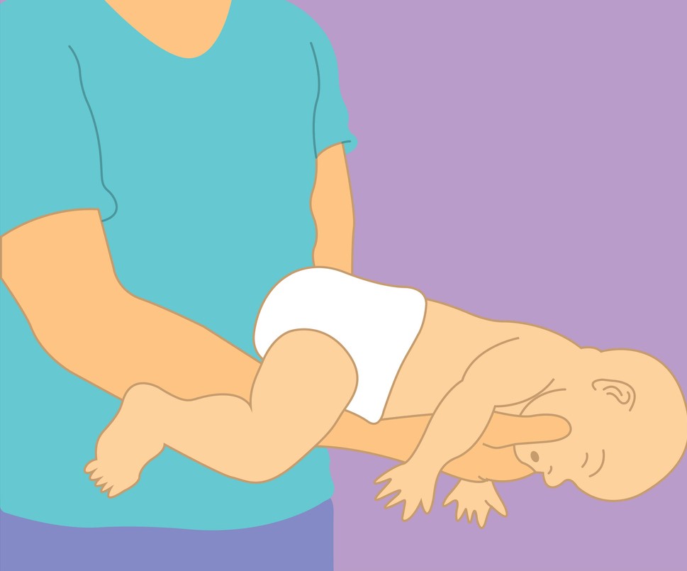 imagine care ilustreaza un parinte care ii face manevra heimlich unui bebelus