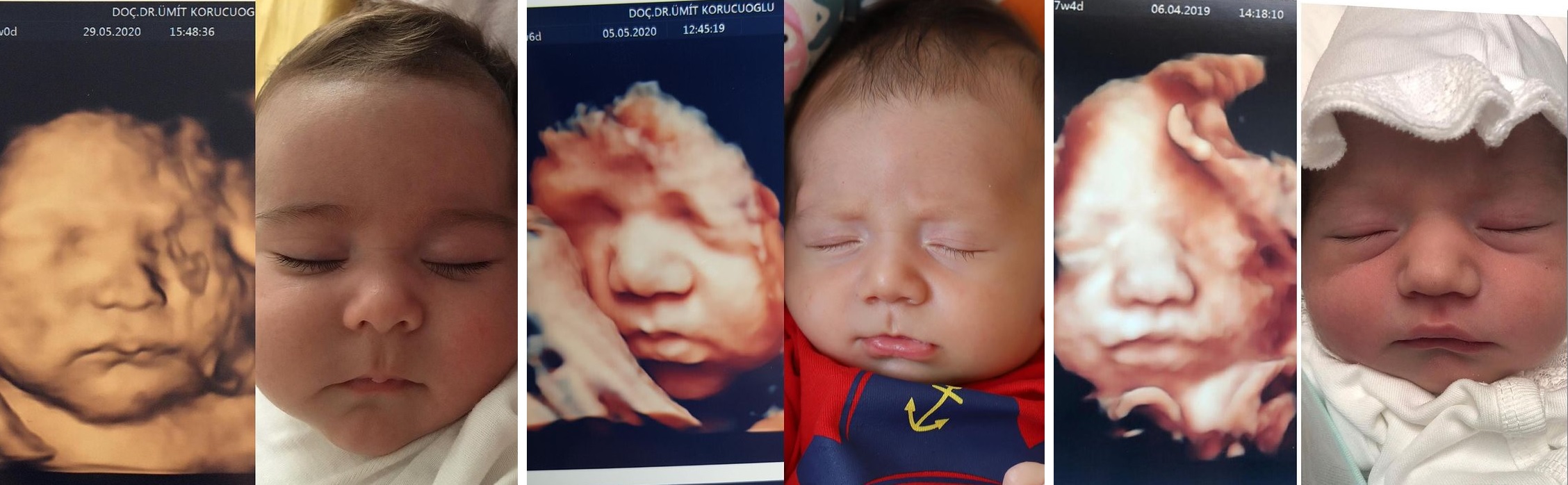 ecografii 4d cu bebelusi in uterul mamei si dupa ce s-au nascut