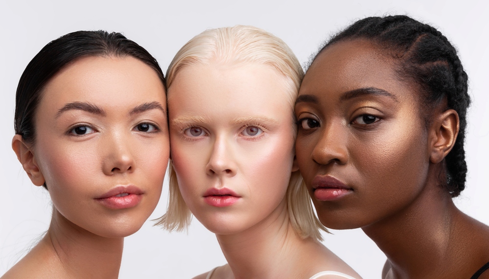 femie cu albinsim asezata intre o femei europeana si o femeie afro-americana