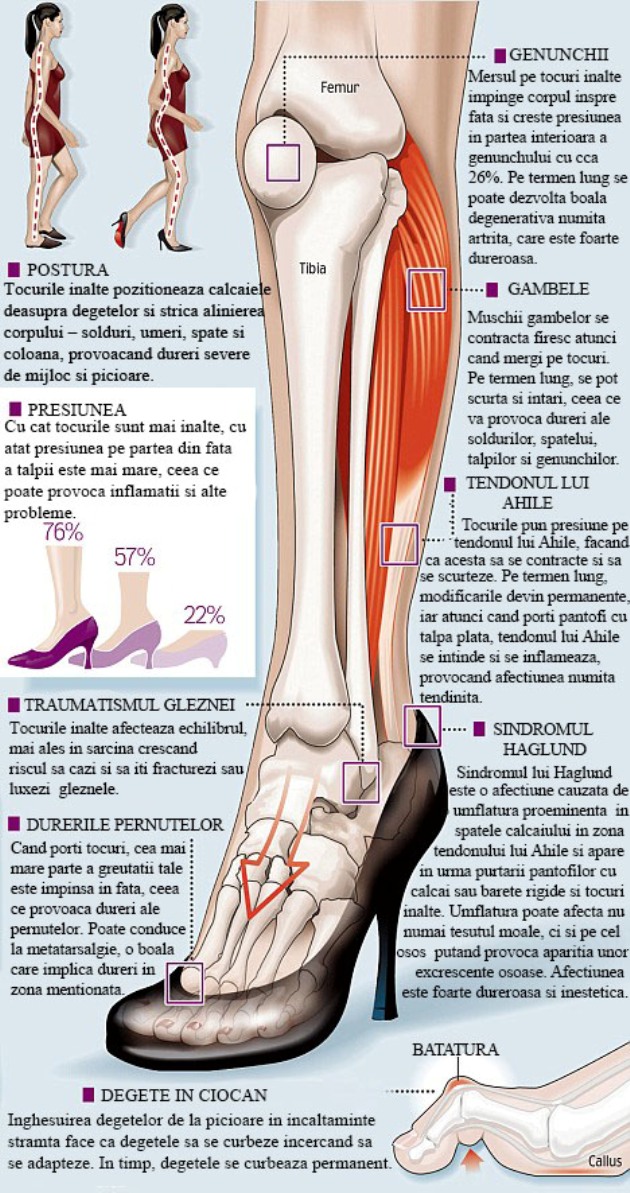 varicarea afecteaza concepia