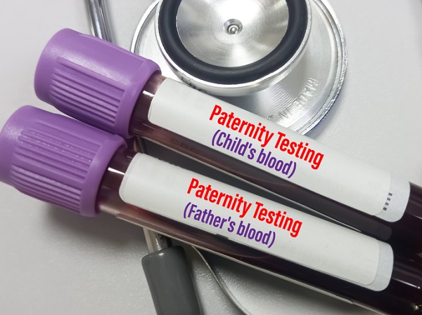 eprubete test de paternitate