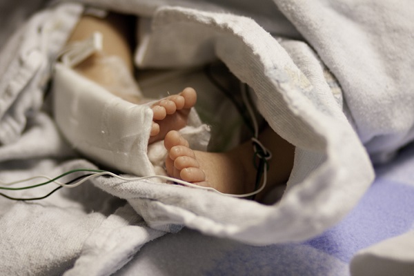 bebelus acoperit cu paturi boala de piele