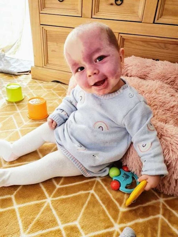 bebelus cu fata purpurie se joaca