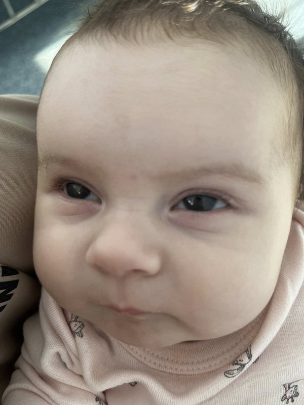 chip de fetita de doua luni care a ajuns la spital cu febra si convulsii