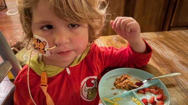 copil cu un tub in nas mananca