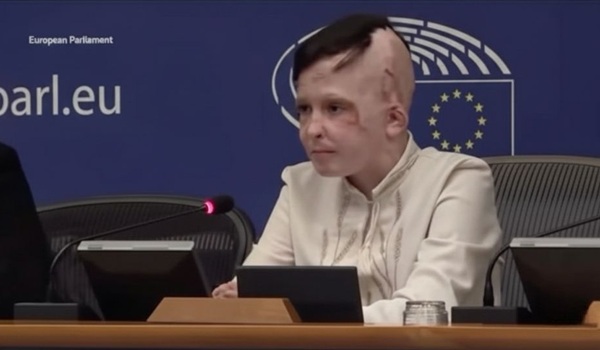 baiat ucrainian cu arsuri grave vorbeste in parlamentul european