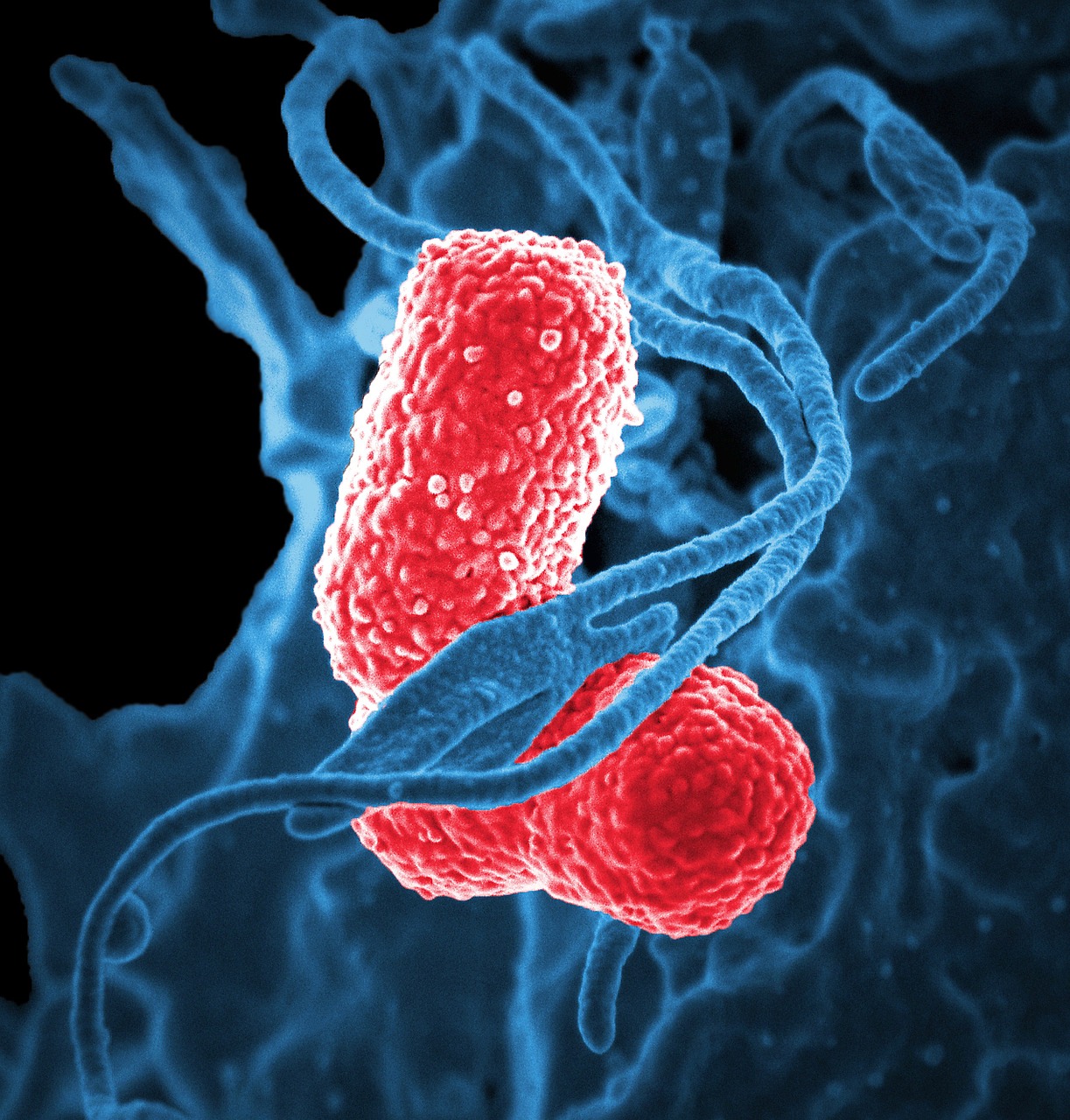 boala Whipple-imagine cu bacterii