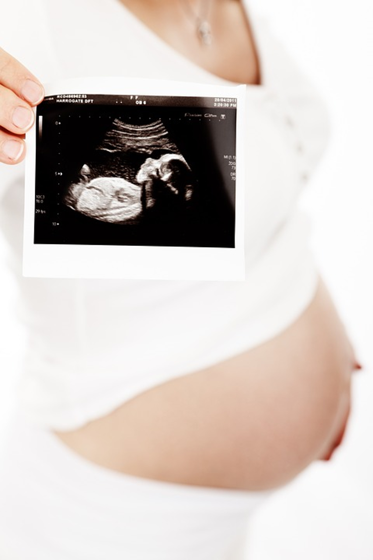 morfologie-fetală-imagine ecografie în sarcină