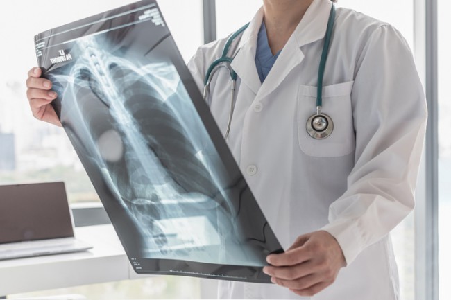 Doctor cu radiografie pulmonara