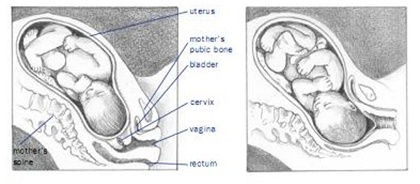 bebelus cu capul spre spatele sau burtica mamei
