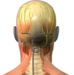 Ganglion occipital