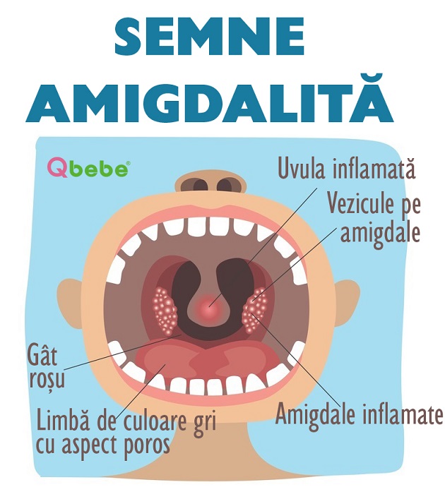 pierderea în greutate nou născută ziua 3